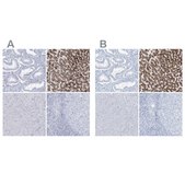 Anti-AGXT antibody produced in rabbit Prestige Antibodies&#174; Powered by Atlas Antibodies, affinity isolated antibody, buffered aqueous glycerol solution
