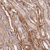Anti-CHCHD2 antibody produced in rabbit Prestige Antibodies&#174; Powered by Atlas Antibodies, affinity isolated antibody, buffered aqueous glycerol solution