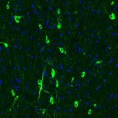 Monoclonal Anti-CHAT antibody produced in mouse Prestige Antibodies® Powered by Atlas Antibodies, clone CL3169, purified immunoglobulin, buffered aqueous glycerol solution