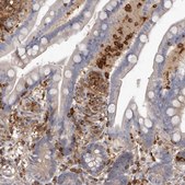 Anti-CBL antibody produced in rabbit Prestige Antibodies&#174; Powered by Atlas Antibodies, affinity isolated antibody, buffered aqueous glycerol solution