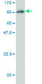 Monoclonal Anti-TKTL1 antibody produced in mouse clone 1C10, purified immunoglobulin, buffered aqueous solution
