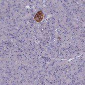 Anti-GAD2 antibody produced in rabbit Prestige Antibodies&#174; Powered by Atlas Antibodies, affinity isolated antibody, buffered aqueous glycerol solution