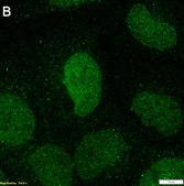 Anti-KEAP1 Antibody, clone 3B9 ZooMAb® Rabbit Monoclonal recombinant, expressed in HEK 293 cells