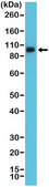 Anti-Integrin beta3/CD61 antibody, Rabbit monoclonal recombinant, expressed in HEK 293 cells, clone RM382, purified immunoglobulin
