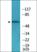 Anti-phospho-Lyn (pTyr507) antibody produced in rabbit affinity isolated antibody