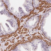 Anti-GPX8 antibody produced in rabbit Prestige Antibodies&#174; Powered by Atlas Antibodies, affinity isolated antibody, buffered aqueous glycerol solution