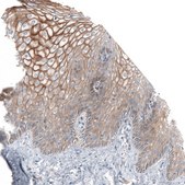 Anti-JAG2 antibody produced in rabbit Prestige Antibodies&#174; Powered by Atlas Antibodies, affinity isolated antibody, buffered aqueous glycerol solution