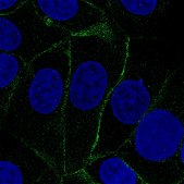 Monoclonal Anti-VANGL1 antibody produced in mouse Prestige Antibodies&#174; Powered by Atlas Antibodies, clone CL0241, purified immunoglobulin, buffered aqueous glycerol solution