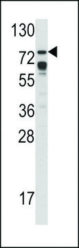 ANTI-B-RAF (S601) antibody produced in rabbit affinity isolated antibody, buffered aqueous solution