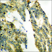 Anti-phospho-PYK2 (pTyr579) antibody produced in rabbit affinity isolated antibody
