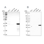 Anti-SULT2A1 antibody produced in rabbit Prestige Antibodies&#174; Powered by Atlas Antibodies, affinity isolated antibody, buffered aqueous glycerol solution