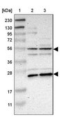 Anti-TNFRSF1A antibody produced in rabbit Prestige Antibodies&#174; Powered by Atlas Antibodies, affinity isolated antibody, buffered aqueous glycerol solution