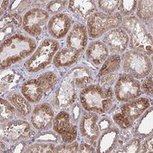 Anti-TNFSF10 antibody produced in rabbit Prestige Antibodies&#174; Powered by Atlas Antibodies, affinity isolated antibody, buffered aqueous glycerol solution