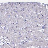 Anti-TNNT3 antibody produced in rabbit Prestige Antibodies&#174; Powered by Atlas Antibodies, affinity isolated antibody, buffered aqueous glycerol solution