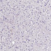 Anti-TNNT2 antibody produced in rabbit Prestige Antibodies&#174; Powered by Atlas Antibodies, affinity isolated antibody, buffered aqueous glycerol solution