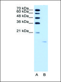 Anti-ACP1 antibody produced in rabbit IgG fraction of antiserum