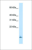 Anti-SCGB1A1 antibody produced in rabbit affinity isolated antibody