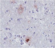 Anti-Amyloid, &#946; 1-40, a&#946; Antibody from rabbit, purified by affinity chromatography
