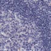 Anti-APOH antibody produced in rabbit Prestige Antibodies&#174; Powered by Atlas Antibodies, affinity isolated antibody, buffered aqueous glycerol solution