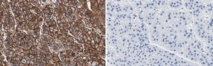 Anti-MDR-1 Antibody, clone 1O12 ZooMAb&#174; Rabbit Monoclonal recombinant, expressed in HEK 293 cells