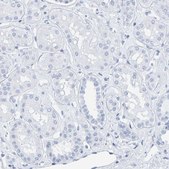 Anti-SFTPC antibody produced in rabbit Prestige Antibodies&#174; Powered by Atlas Antibodies, affinity isolated antibody, buffered aqueous glycerol solution, Ab1
