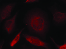 Anti-SMAD3 (Ab-208) antibody produced in rabbit affinity isolated antibody