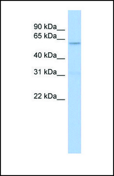 Anti-CAMKK2, (N-terminal) antibody produced in rabbit affinity isolated antibody
