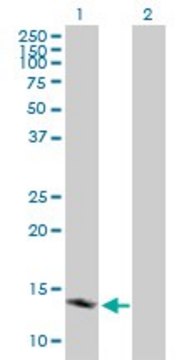 Anti-TSPO antibody produced in mouse purified immunoglobulin, buffered aqueous solution
