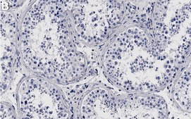 Anti-COIL Antibody, clone 2K14-2 ZooMAb&#174; Rabbit Monoclonal recombinant, expressed in HEK 293 cells