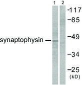 Anti-Synaptophysin antibody produced in rabbit affinity isolated antibody