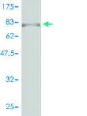 Monoclonal Anti-RARA antibody produced in mouse clone 2C9-1F8, purified immunoglobulin, buffered aqueous solution