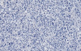 Anti-PTEN Antibody, clone 6H2.1 ZooMAb&#174; Mouse Monoclonal recombinant, expressed in HEK 293 cells