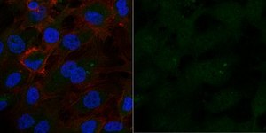 Anti-PP2A, C subunit Antibody, clone 1D6, Alexa Fluor&#8482; 488 Conjugate clone 1D6, from mouse, ALEXA FLUOR&#8482; 488