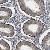 Anti-CBLB antibody produced in rabbit Prestige Antibodies&#174; Powered by Atlas Antibodies, affinity isolated antibody, buffered aqueous glycerol solution