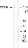 Anti-CSFR antibody produced in rabbit affinity isolated antibody