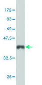 Monoclonal Anti-ATR antibody produced in mouse clone 3F2, purified immunoglobulin, buffered aqueous solution