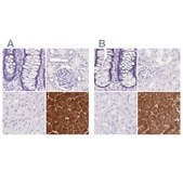Anti-PNLIP antibody produced in rabbit Prestige Antibodies&#174; Powered by Atlas Antibodies, affinity isolated antibody, buffered aqueous glycerol solution