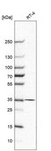 Anti-MDH1 antibody produced in rabbit affinity isolated antibody, buffered aqueous glycerol solution, ab1