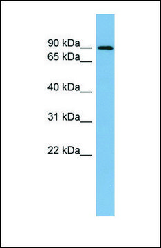 Anti-TBK1 antibody produced in rabbit affinity isolated antibody