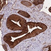 Anti-PLD1 antibody produced in rabbit Prestige Antibodies&#174; Powered by Atlas Antibodies, affinity isolated antibody, buffered aqueous glycerol solution