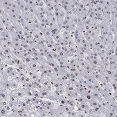 Anti-HMGA1 antibody produced in rabbit Prestige Antibodies&#174; Powered by Atlas Antibodies, affinity isolated antibody, buffered aqueous glycerol solution