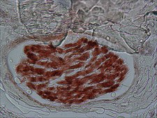 Monoclonal Anti-S-100 (&#946;-Subunit) antibody produced in mouse clone SH-B1, ascites fluid