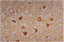 Monoclonal Anti-Neurofilament H, purified produced in mouse