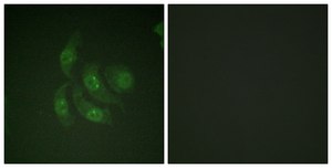 Anti-CAMK4 antibody produced in rabbit affinity isolated antibody