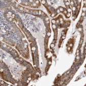 Anti-CPT2 antibody produced in rabbit Prestige Antibodies&#174; Powered by Atlas Antibodies, affinity isolated antibody, buffered aqueous glycerol solution, ab1