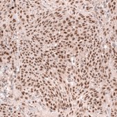 Monoclonal Anti-Msh3 Antibody Produced In Mouse Prestige Antibodies&#174; Powered by Atlas Antibodies, clone CL14064, affinity isolated antibody, buffered aqueous glycerol solution