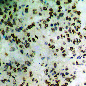 Anti-phospho-Catenin-&#948;1 (pTyr228) antibody produced in rabbit affinity isolated antibody