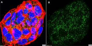 Anti-Lactotransferrin Antibody, clone 1D15 ZooMAb&#174; Rabbit Monoclonal recombinant, expressed in HEK 293 cells