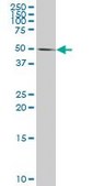 Monoclonal Anti-CASP10, (N-terminal) antibody produced in mouse clone 2E7, purified immunoglobulin, buffered aqueous solution