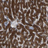 Anti-FTCD antibody produced in rabbit Prestige Antibodies&#174; Powered by Atlas Antibodies, affinity isolated antibody, buffered aqueous glycerol solution